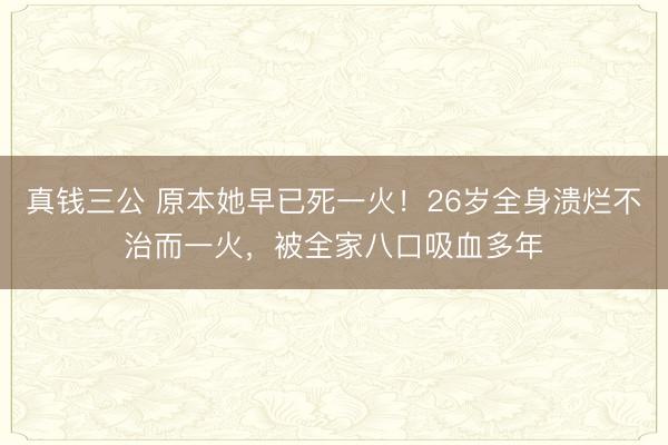真钱三公 原本她早已死一火！26岁全身溃烂不治而一火，被全家八口吸血多年
